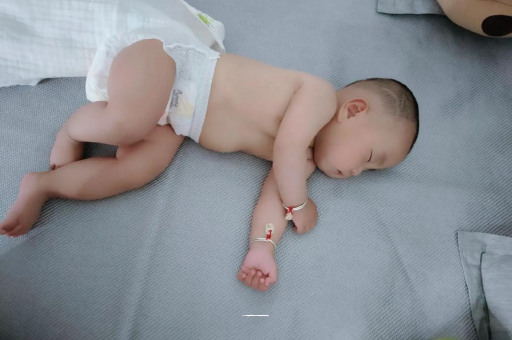 南通六个月宝宝眼睛散光